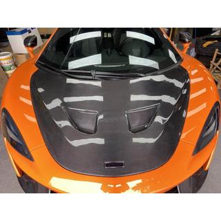 Motorkap (carbon) McLaren 540C/570S 2015–2020 foto 2